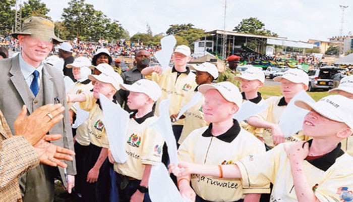 Cartes d'égalité des chances: Les albinos invités tous à faire les démarches auprès des services compétents