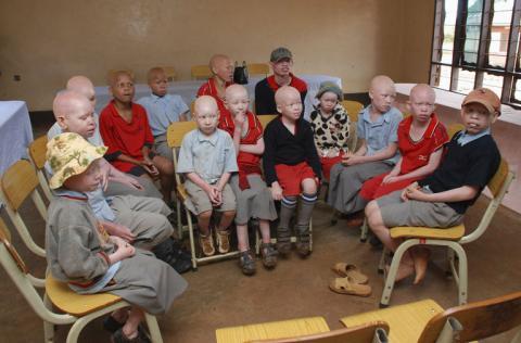 THIES: Le centre de réinsertion des albinos de Sampathé réhabilité