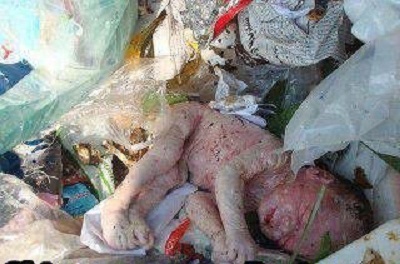 Un bébé retrouvé dans les ordures à Grand Yoff.