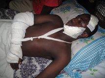 Fauché par le cortège de Macky Sall à Ziguinchor: Un jeune homme lutte contre la mort