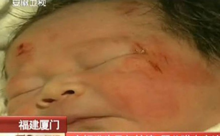 CHINE: Un bébé expulsé du ventre de sa mère lors d'un accident de la route