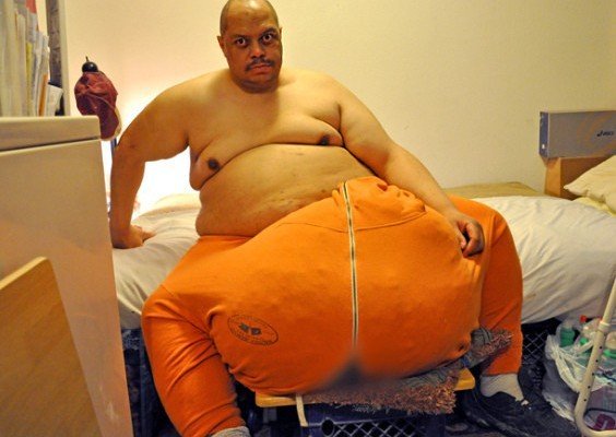 (3) Photos: L’homme aux testicules de 45 kilos est décédé… Regardez