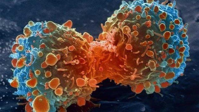 Des chercheurs iraniens ont trouvé un traitement de lutte et de prévention contre le cancer