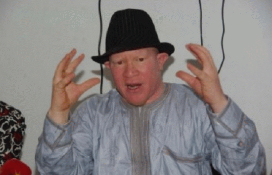 Sorcellerie, Mouhamadou Bamba Diop : «Je me demande si les albinos ne doivent pas quitter le Sénégal».