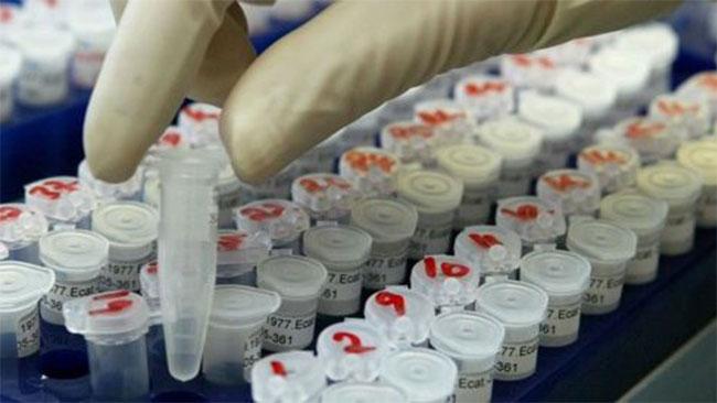 Accès difficile aux tests ADN: Et si l'Etat prenait en charge les coûts des tests?