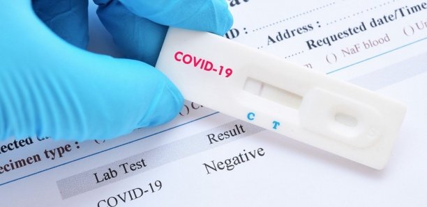 covid-19, les chiffres du Jour: 504 nouveaux cas testés positifs au coronavirus, 386 nouveaux guéris, 9 nouveaux décès et 63 cas graves en réanimation.