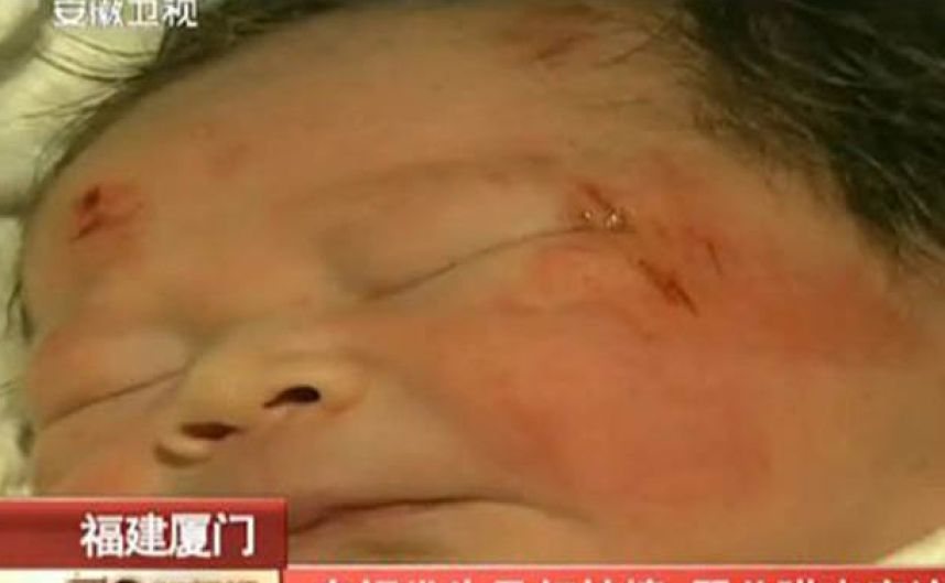 CHINE: Un bébé expulsé du ventre de sa mère lors d'un accident de la route