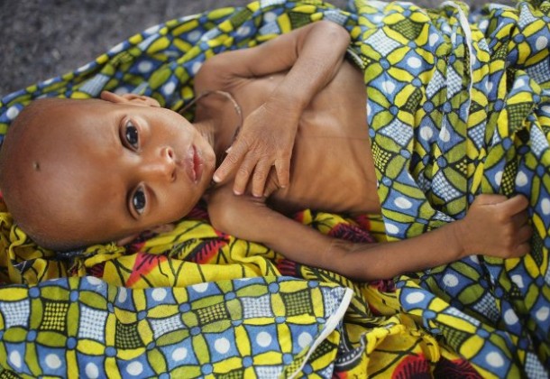 Santé « mère-enfant » à Matam : 0 gynécologue, 532 mort-nés et 54 femmes mortes en couches en 2014
