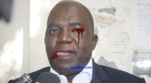 Agression du député Oumar Sarr