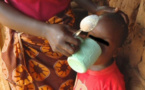 Malnutrion: "Taux de prévalence acceptable"  de 15% à Thiès