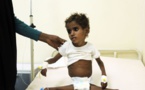 Crise humanitaire: Au Yémen, un enfant meurt toutes les dix minutes(LEXPRESS)