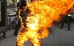 Saint-Louis : Un jeune artiste tente de s’immoler par le feu