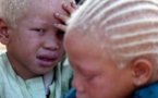 Cheikh Seck face aux députés du Pds « Depuis que vous avez perdu le pouvoir les Albinos ont trouvé la Paix »