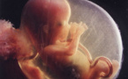 Avortement médicalisé: "une négation du droit à la vie, une porte ouverte au vagabondage sexuel" selon Jamra et Mbañ Gacce