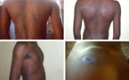 DROITSHUMAINS: La torture, un phénomène peu pénalisé en Afrique (Amnesty International)
