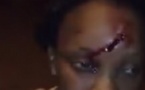 (Vidéo) Racisme au Maroc : une congolaise sauvagement battue et blessée. Regardez