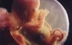 Première en France : un fœtus a été opéré in utéro d'une malformation congénitale