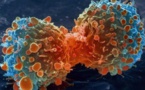 Des chercheurs iraniens ont trouvé un traitement de lutte et de prévention contre le cancer
